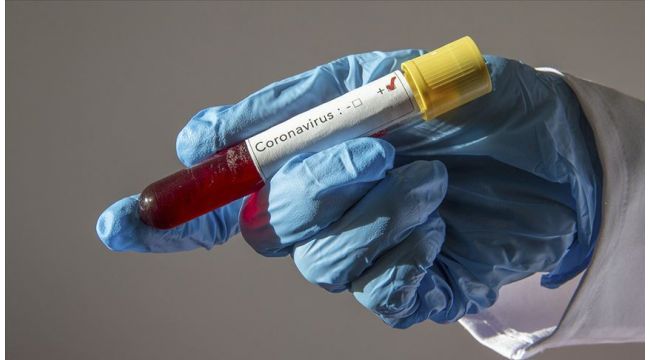 Dünya genelinde Kovid-19 vaka sayısı 2 milyon 200 bini aştı