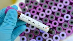 Koronavirüs geçiren kişilerde başka bir bulgu ortaya çıkabilir mı?