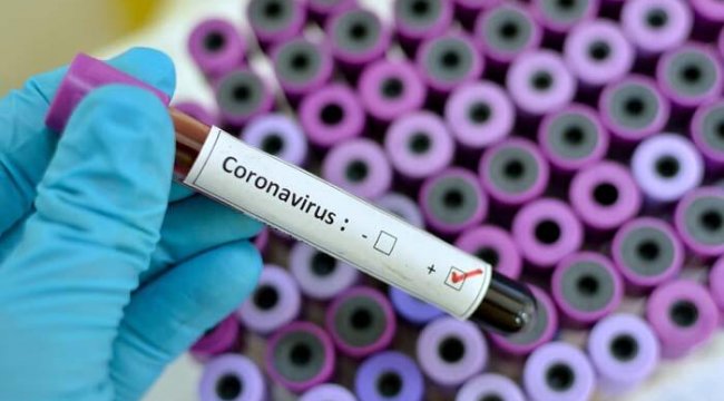 Koronavirüsten korunmada etkili yöntem 'Ağız Gargarası'